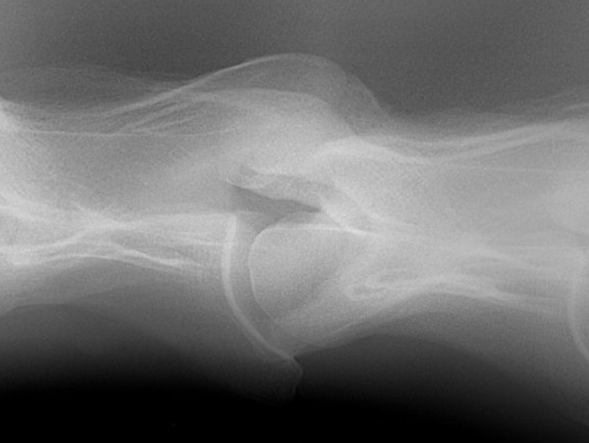 Radiografia digitale — Clinica Equina Andromeda