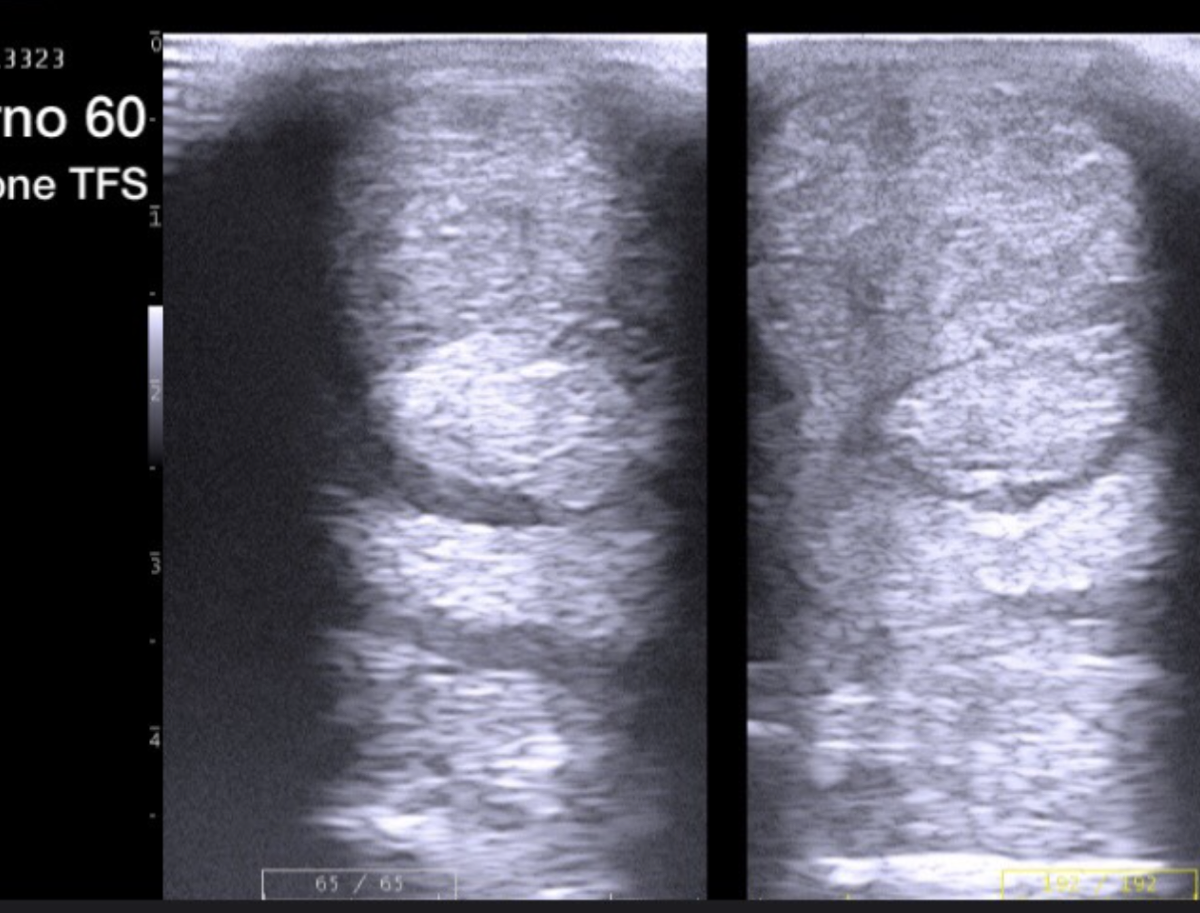 Terapia rigenerativa — Clinica Equina Andromeda